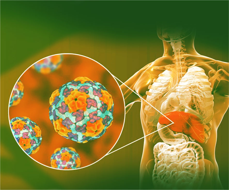Гепатит В: симптомы и лечение